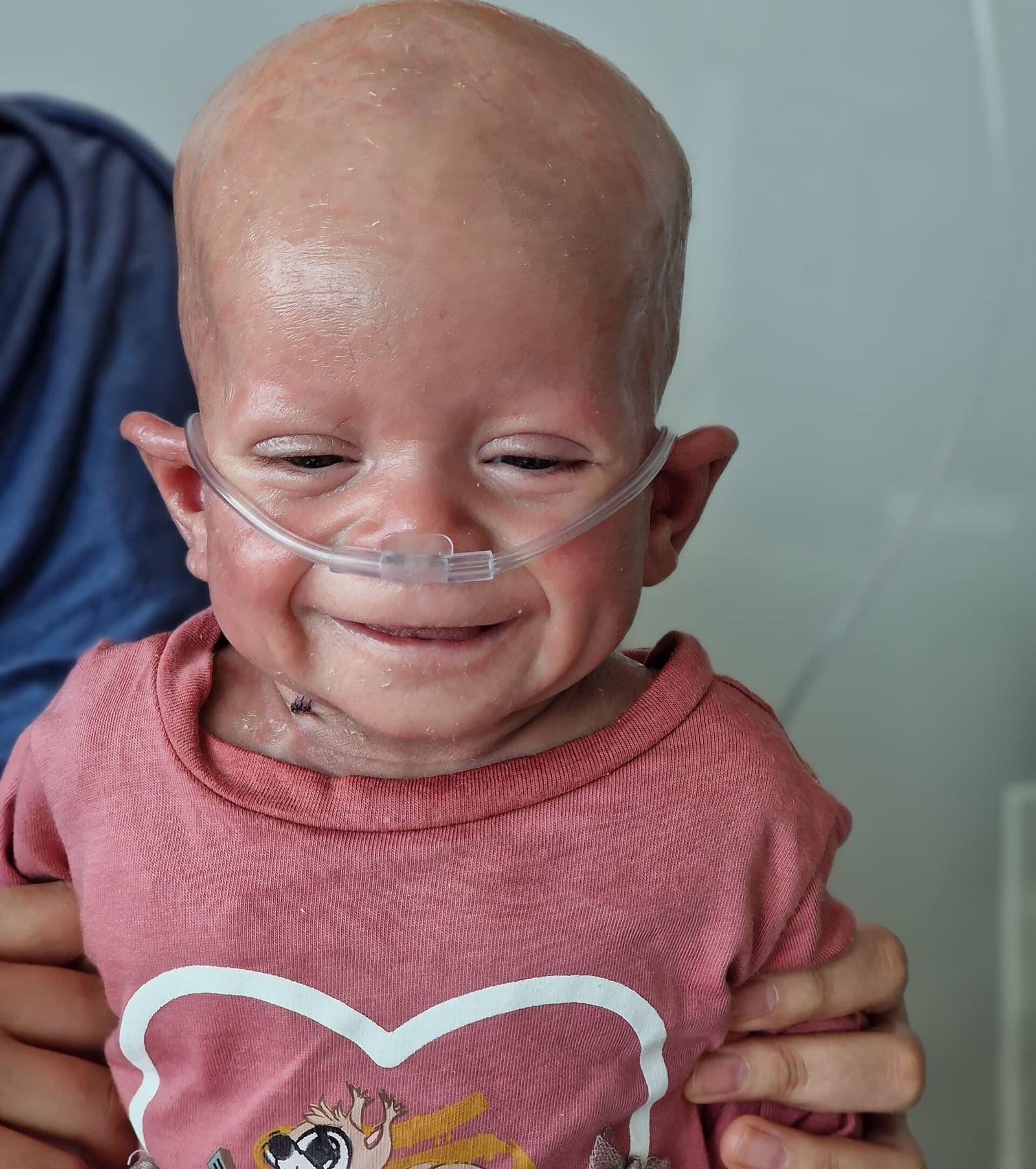 Bébé accompagné par SOS Greffe